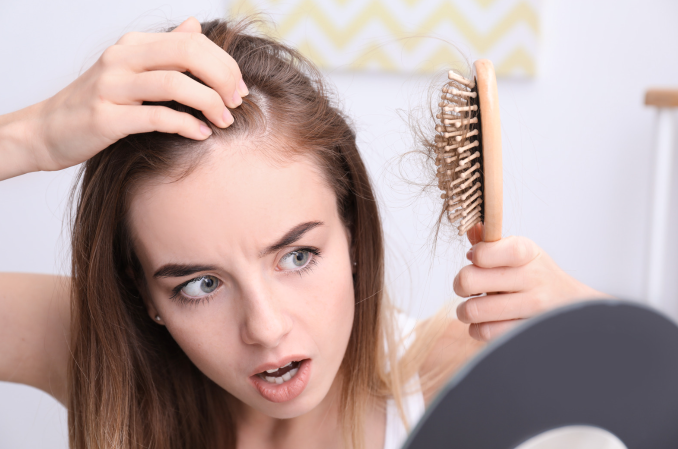 Spironolactone and Minoxidil for Female Hair Loss